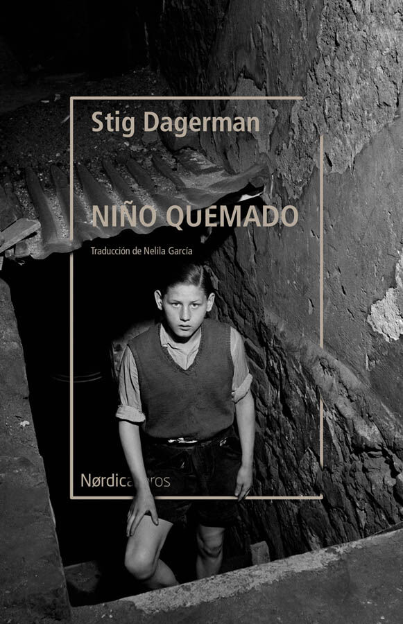 Ni&ntilde;o quemado