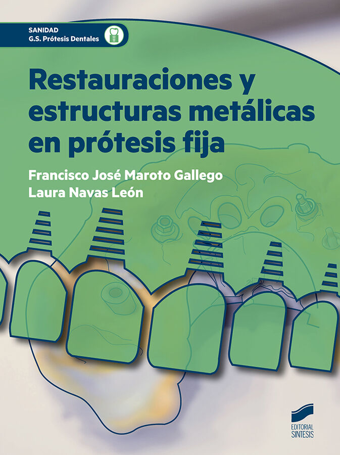 SINTESIS CFGS Rest. Est. Met&aacute;l. Pr&oacute;tesis