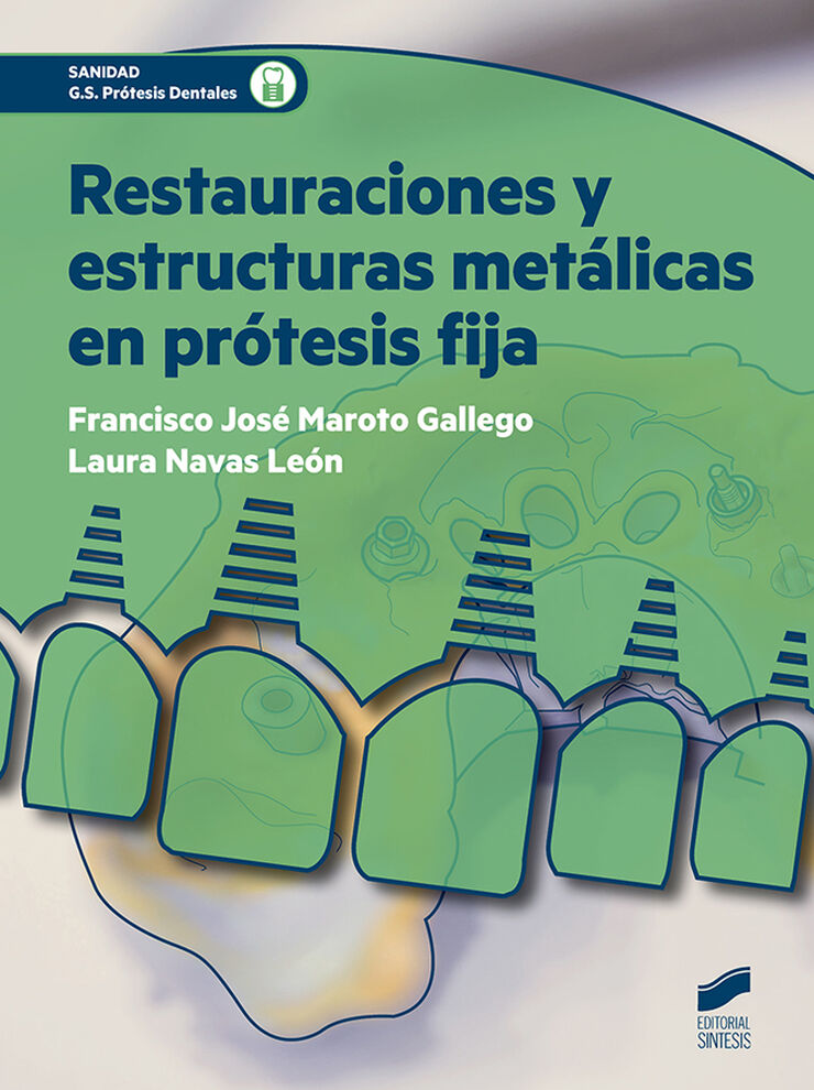 SINTESIS CFGS Rest. Est. Met&aacute;l. Pr&oacute;tesis