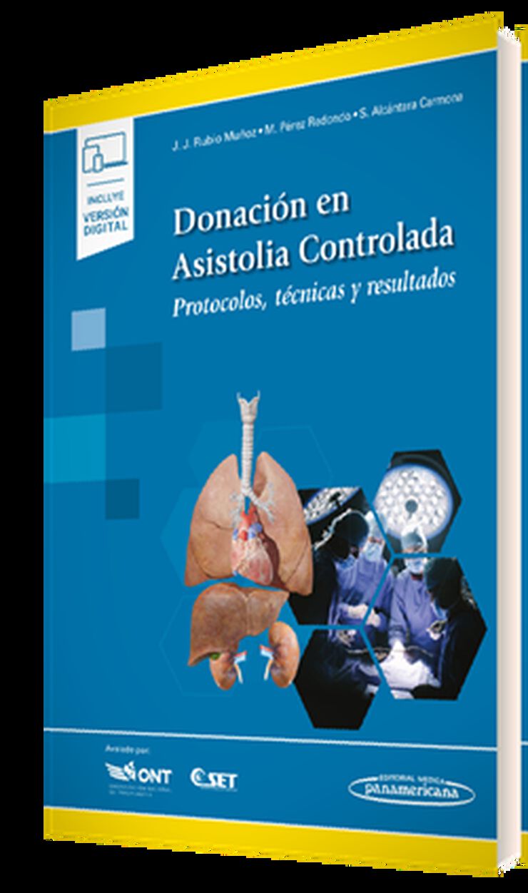 Donaci&oacute;n en Asistolia Controlada (+e-book)