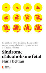 Síndrome d'alcoholisme fetal Síndrome d'alcoholisme fetal