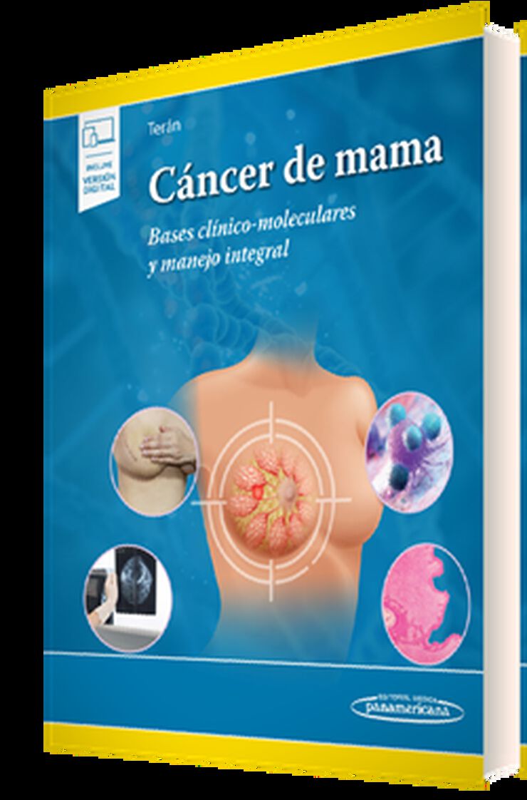 C&aacute;ncer de mama (+e-book)