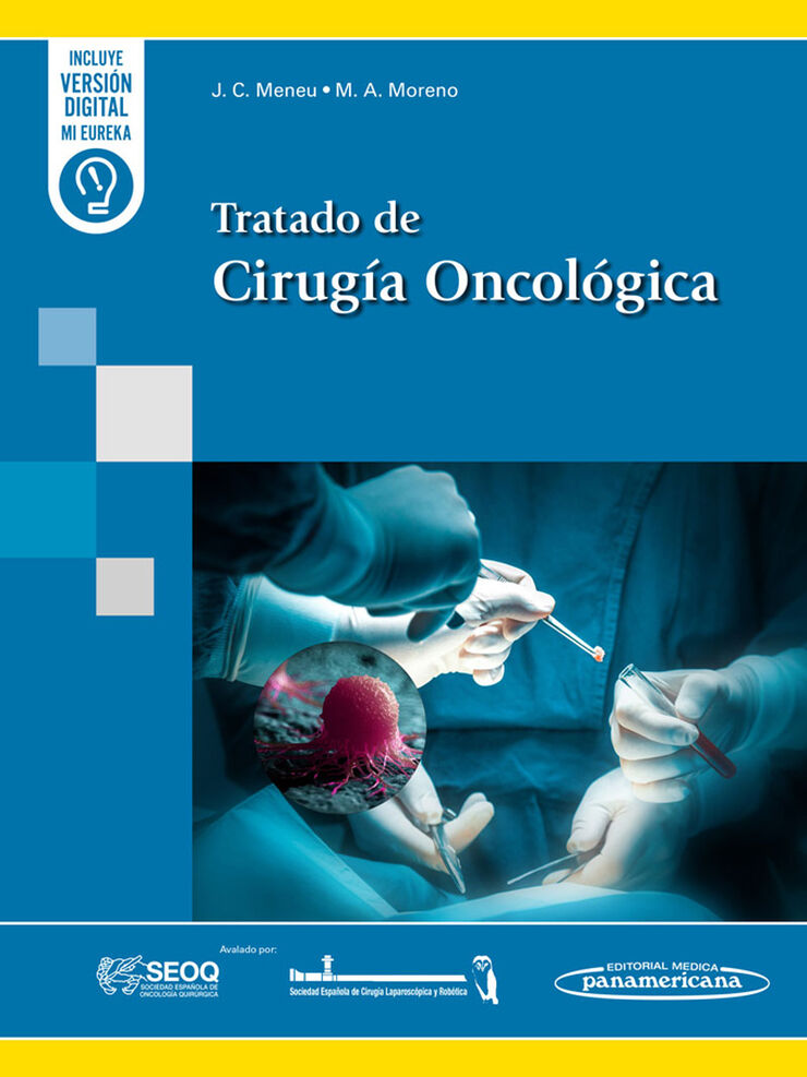 Tratado de Cirug&iacute;a Oncol&oacute;gica(+e-book)
