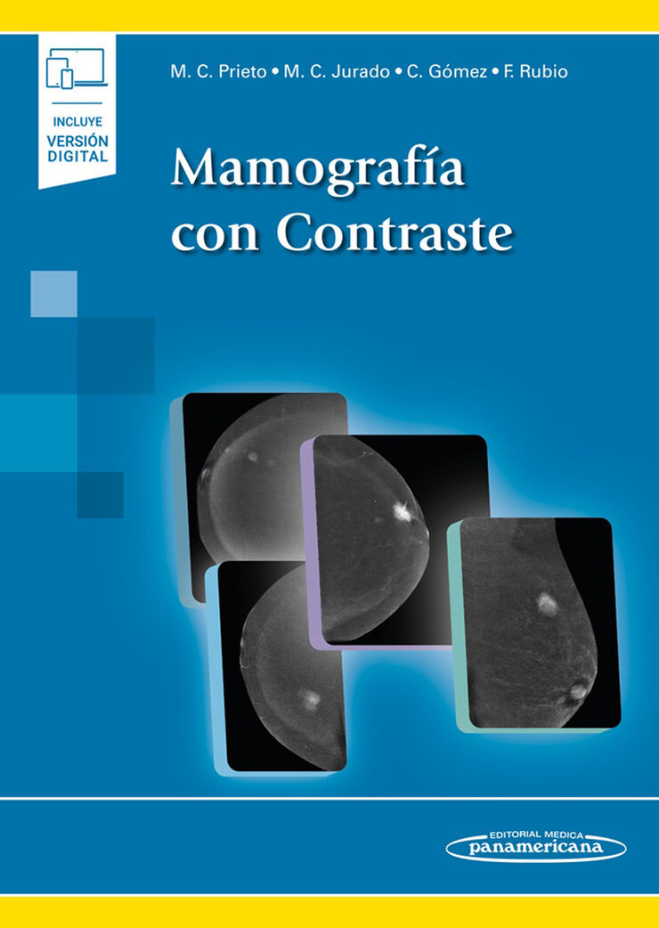 Mamograf&iacute;a con Contraste (+ebook)