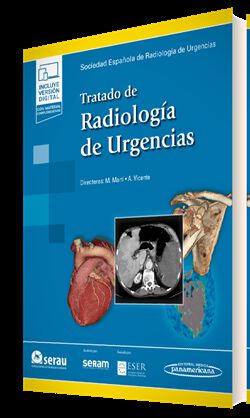 Tratado de Radiolog&iacute;a de Urgencias (+ ebook)