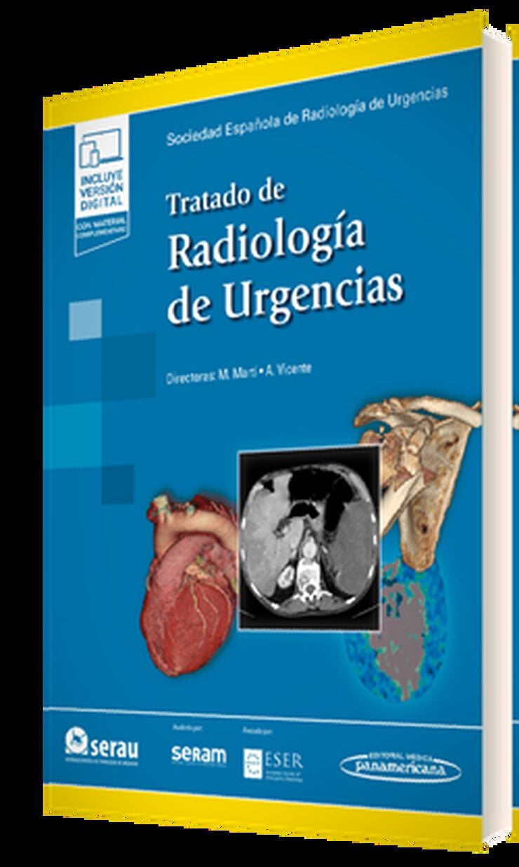 Tratado de Radiolog&iacute;a de Urgencias (+ ebook)