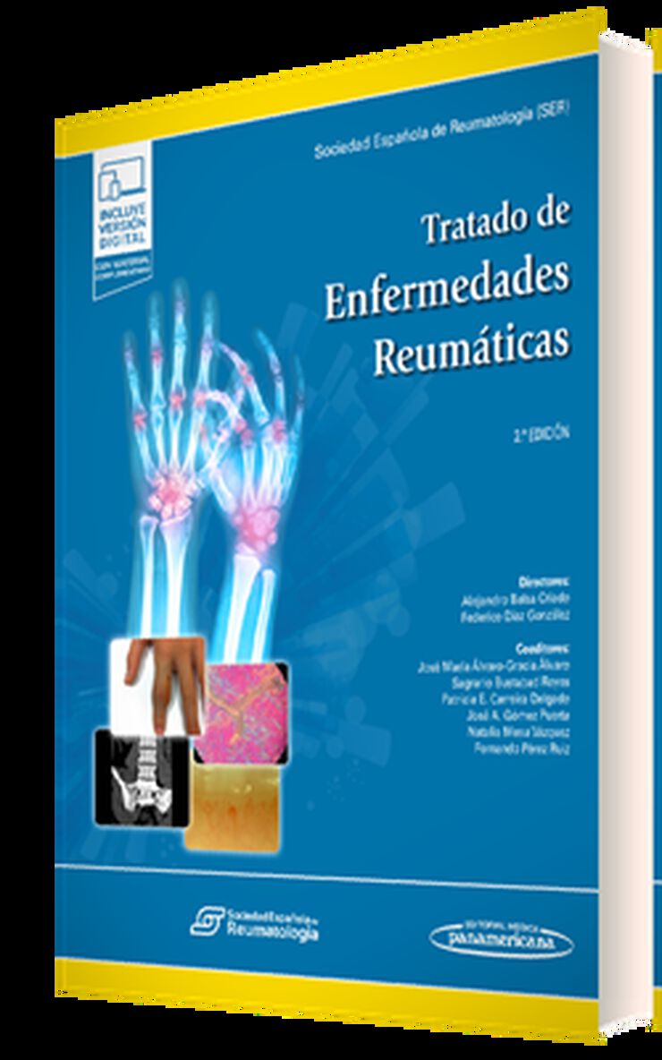 Tratado de Enfermedades Reum&aacute;ticas (+e-book)
