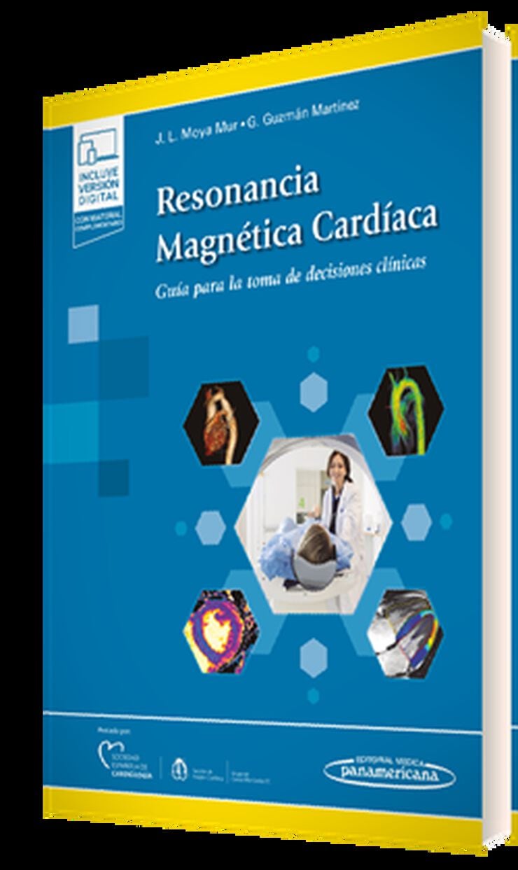 Resonancia Magn&eacute;tica Card&iacute;aca (+ebook)