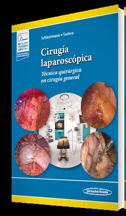 Cirug&iacute;a laparosc&oacute;pica (+e-book)
