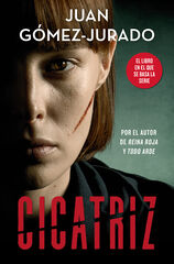 Cicatriz Cicatriz