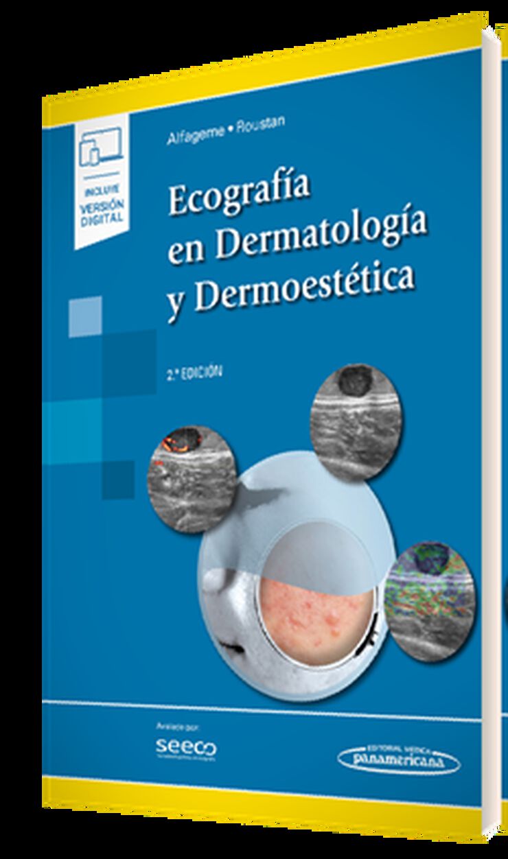 Ecograf&iacute;a en Dermatolog&iacute;a y Dermoest&eacute;tica