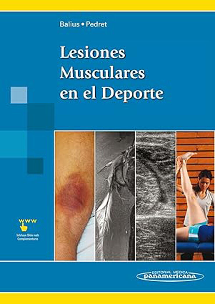 Lesiones Musculares en el Deporte
