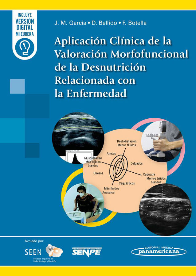 Aplicaci&oacute;n Cl&iacute;nica de la Valoraci&oacute;n Morfofuncional de la Desnutrici&oacute;n Relacionada con la Enfermedad