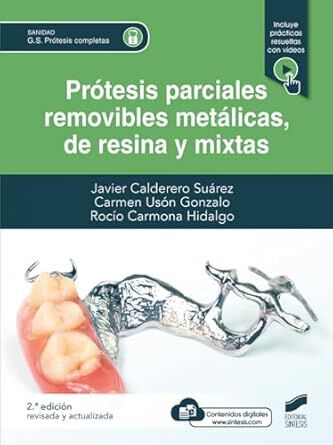 Pr&oacute;tesis parciales removibles met&aacute;licas, de resina y mixta (2&ordf; edici&oacute;n revisada y actualizada)
