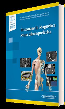 Resonancia Magn&eacute;tica Musculoesquel&eacute;tica