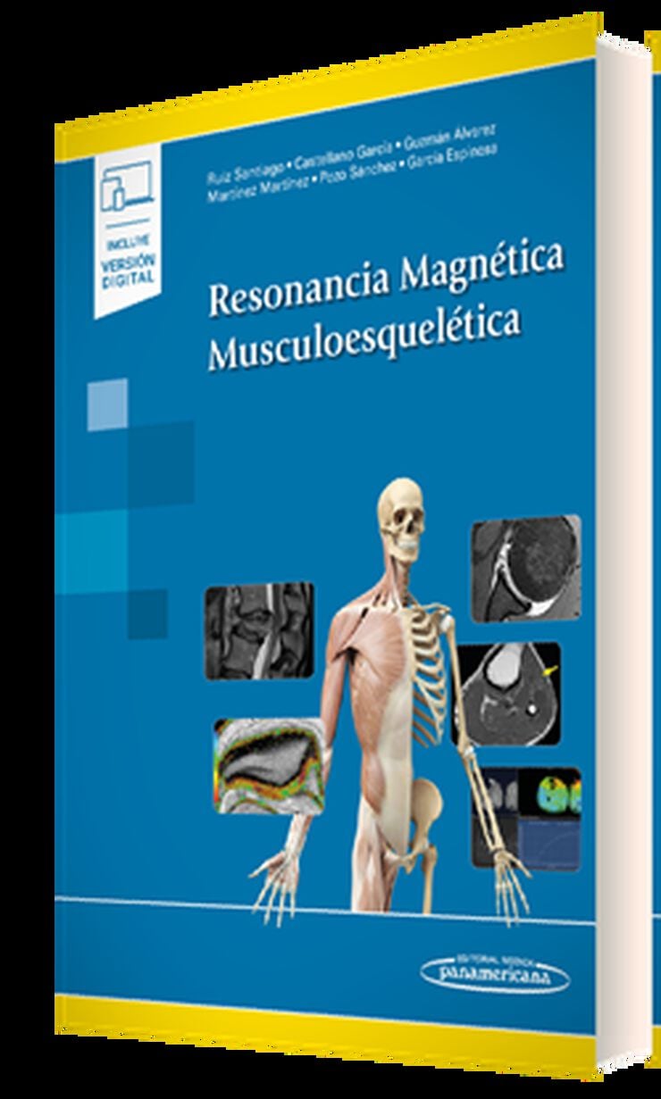 Resonancia Magn&eacute;tica Musculoesquel&eacute;tica