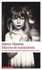 Marcas de nacimiento Marcas de nacimiento