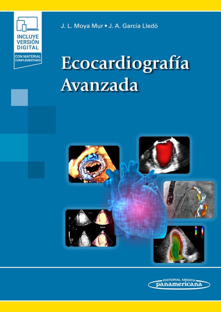 Ecocardiograf&iacute;a Avanzada + e-book
