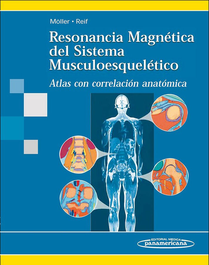 Resonancia Magn&eacute;tica del Sistema Musculoesquel&eacute;tico