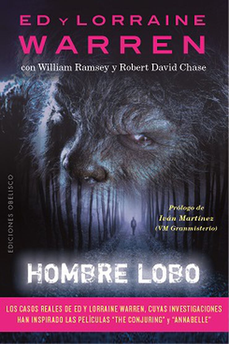 Hombre lobo