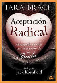 Aceptaci&oacute;n radical