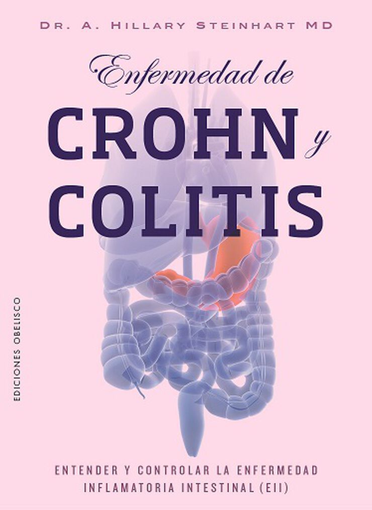 Enfermedad de Crohn y colitis