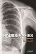 Radiografies