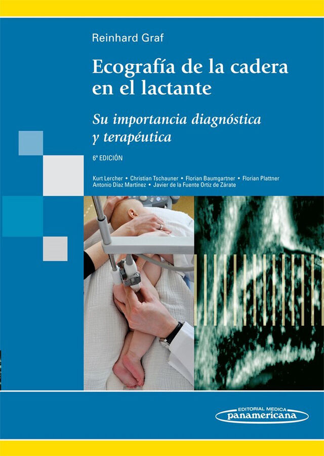 Ecograf&iacute;a de la cadera en el lactante. Su importancia diagn&oacute;stica y terap&eacute;utica