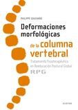 Deformaciones morfol&oacute;gicas de la columna