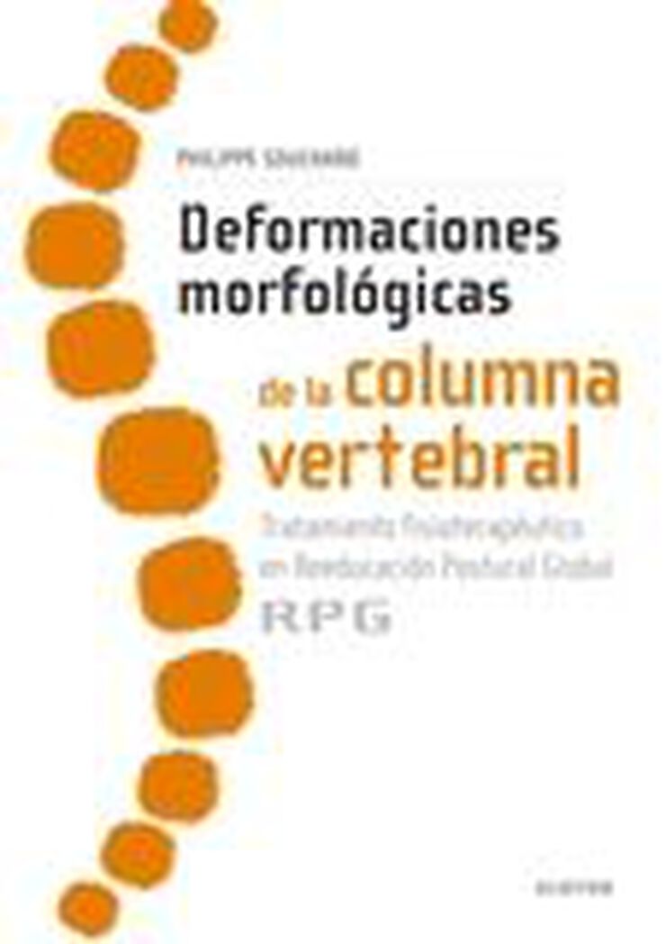 Deformaciones morfol&oacute;gicas de la columna
