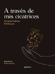 A través de mis cicatrices. 10kveces