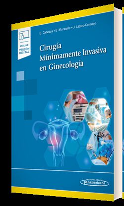 Cirug&iacute;a M&iacute;nimamente Invasiva en Ginecolog&iacute;a