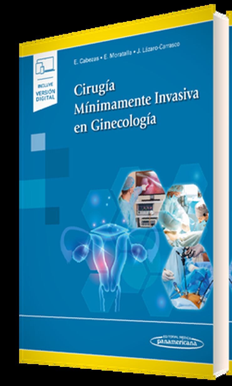 Cirug&iacute;a M&iacute;nimamente Invasiva en Ginecolog&iacute;a