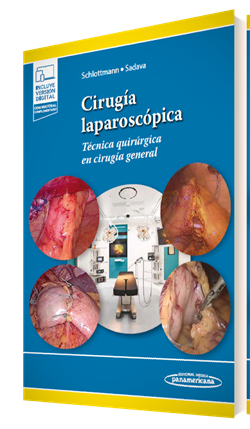 Cirugía laparoscópica