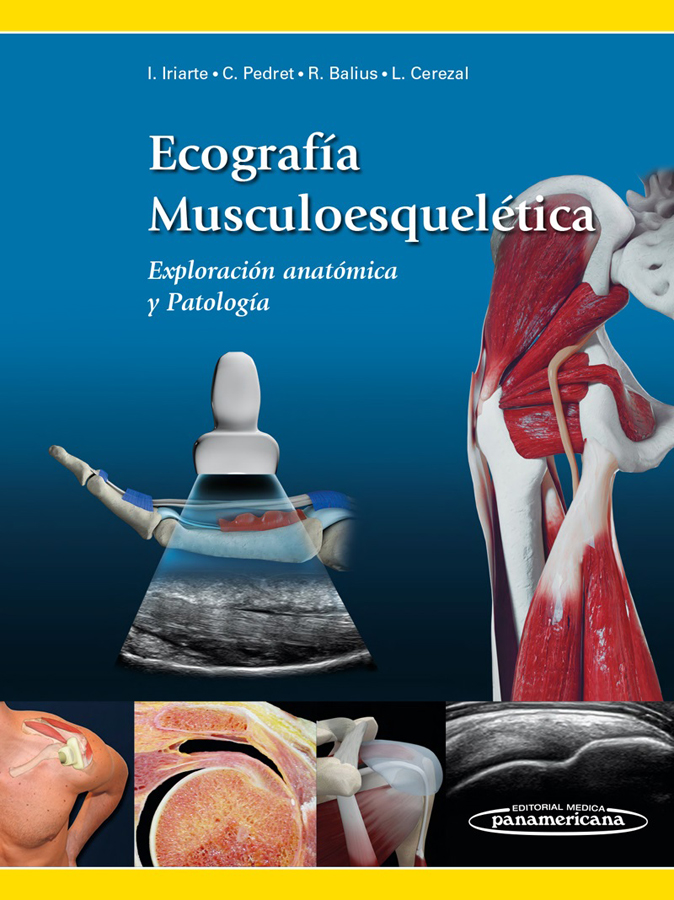 Ecografía Musculoesquelética. Exploración anatómica y Patología